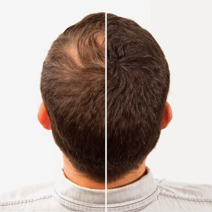 Top Hair Growth Hair Oils for Men